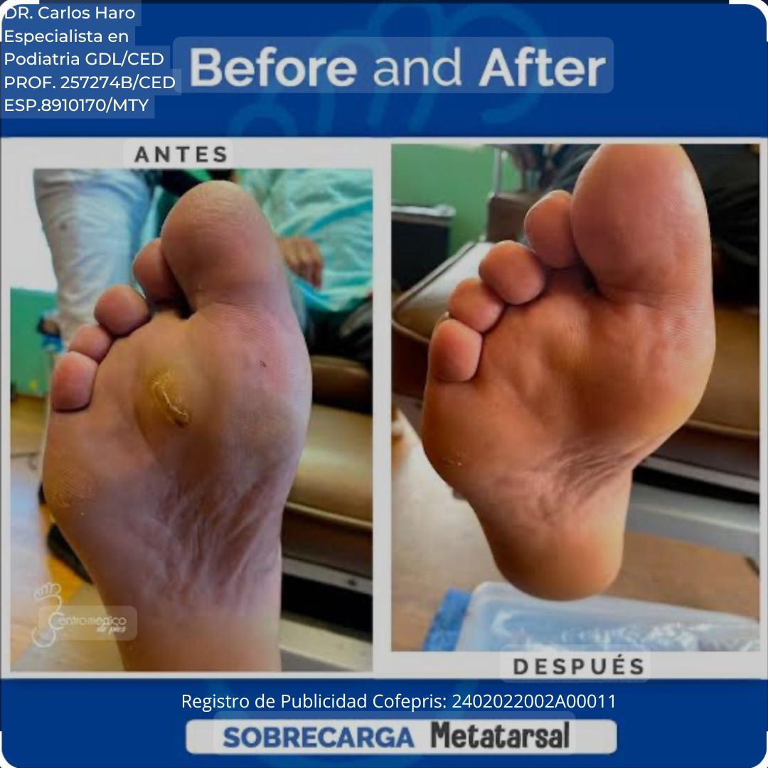 Carlos Alberto Haro Prieto-9