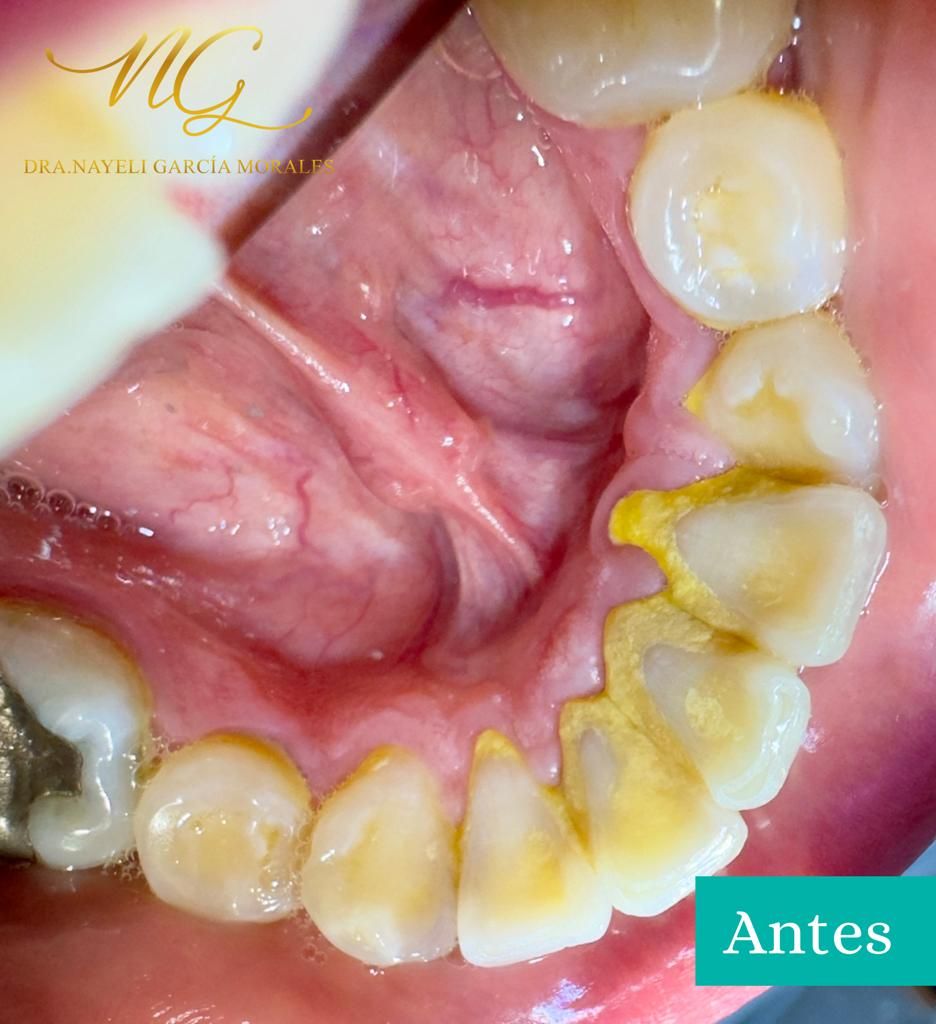 Nayeli Garcia Morales-20