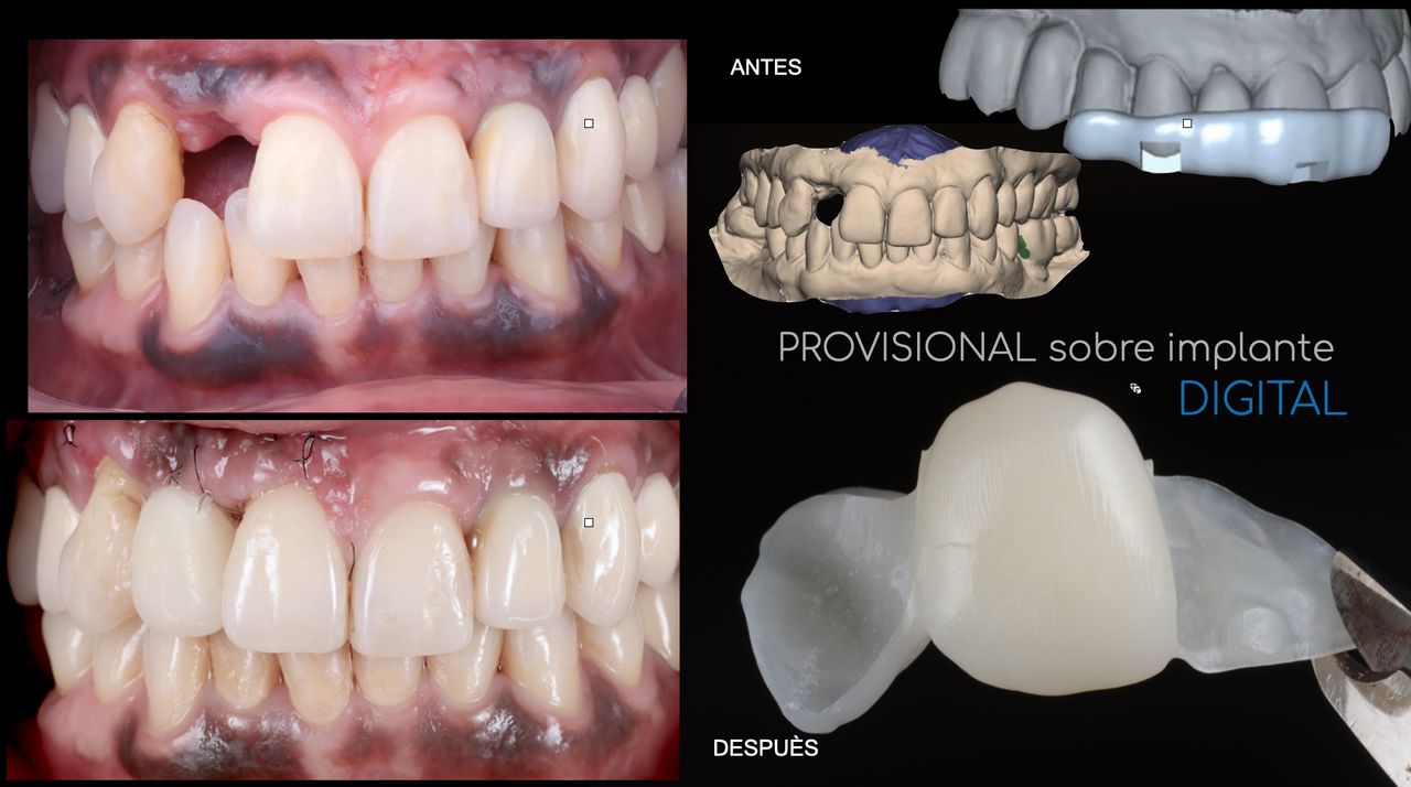 J. Ricardo Martínez-12