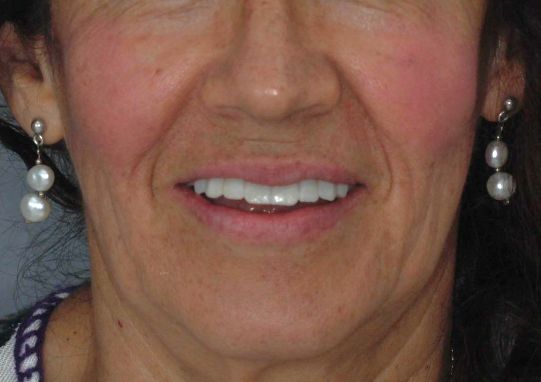 Guillermo García Garduño-27