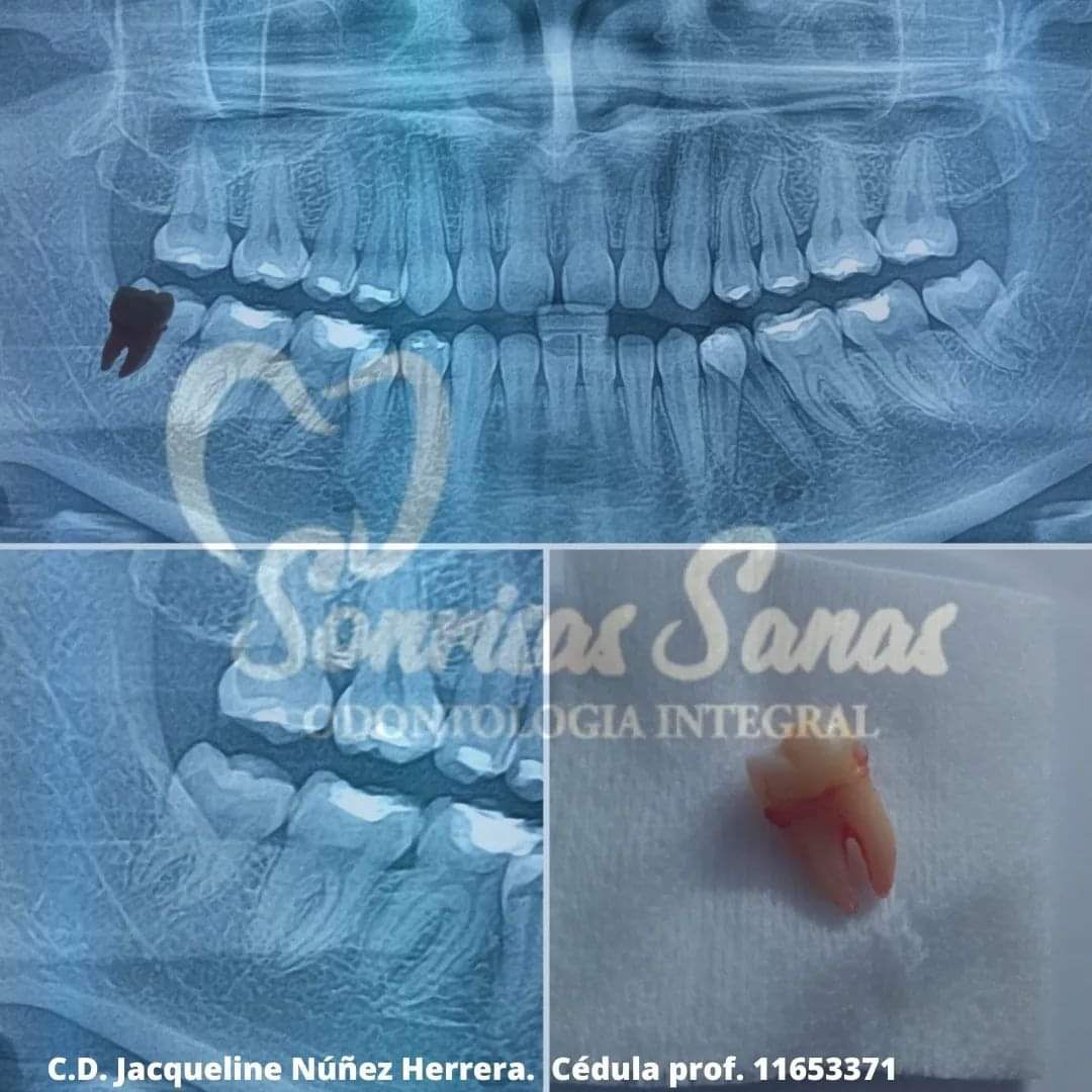 Jacqueline Nuñez Herrera-3