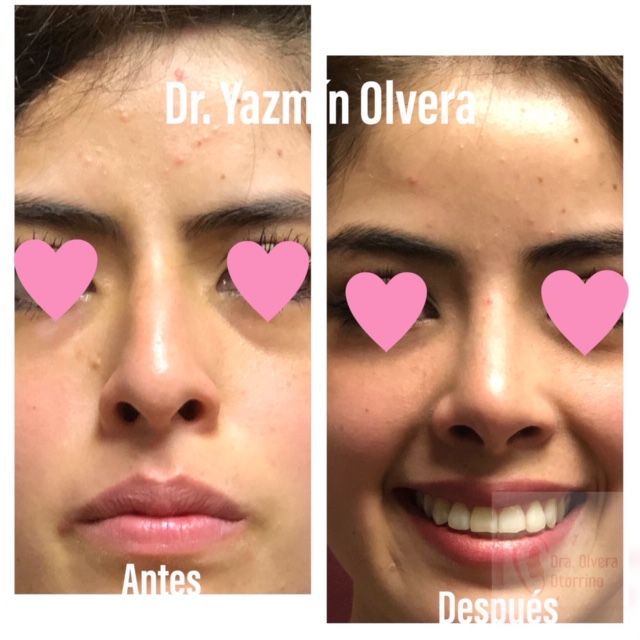 Ma. Yazmín Olvera Suárez-81