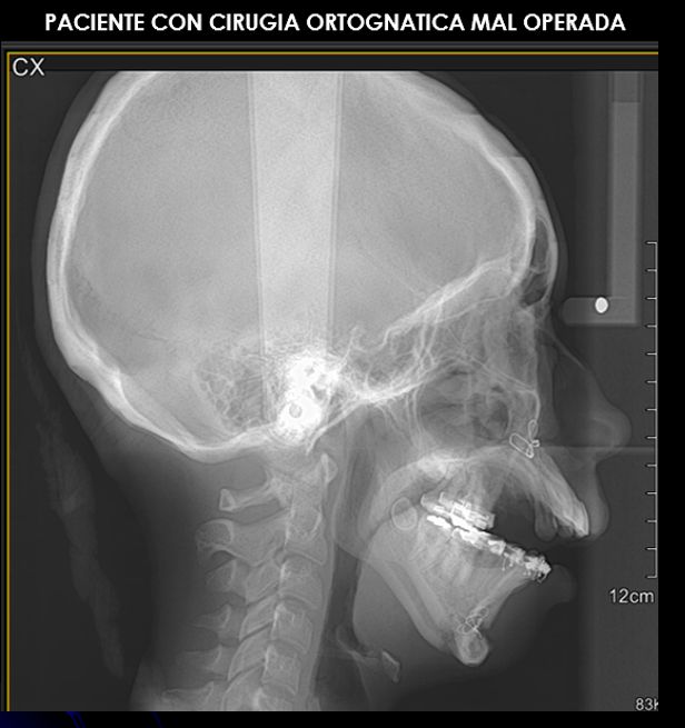 Victor Hugo Sepulveda Núñez-4