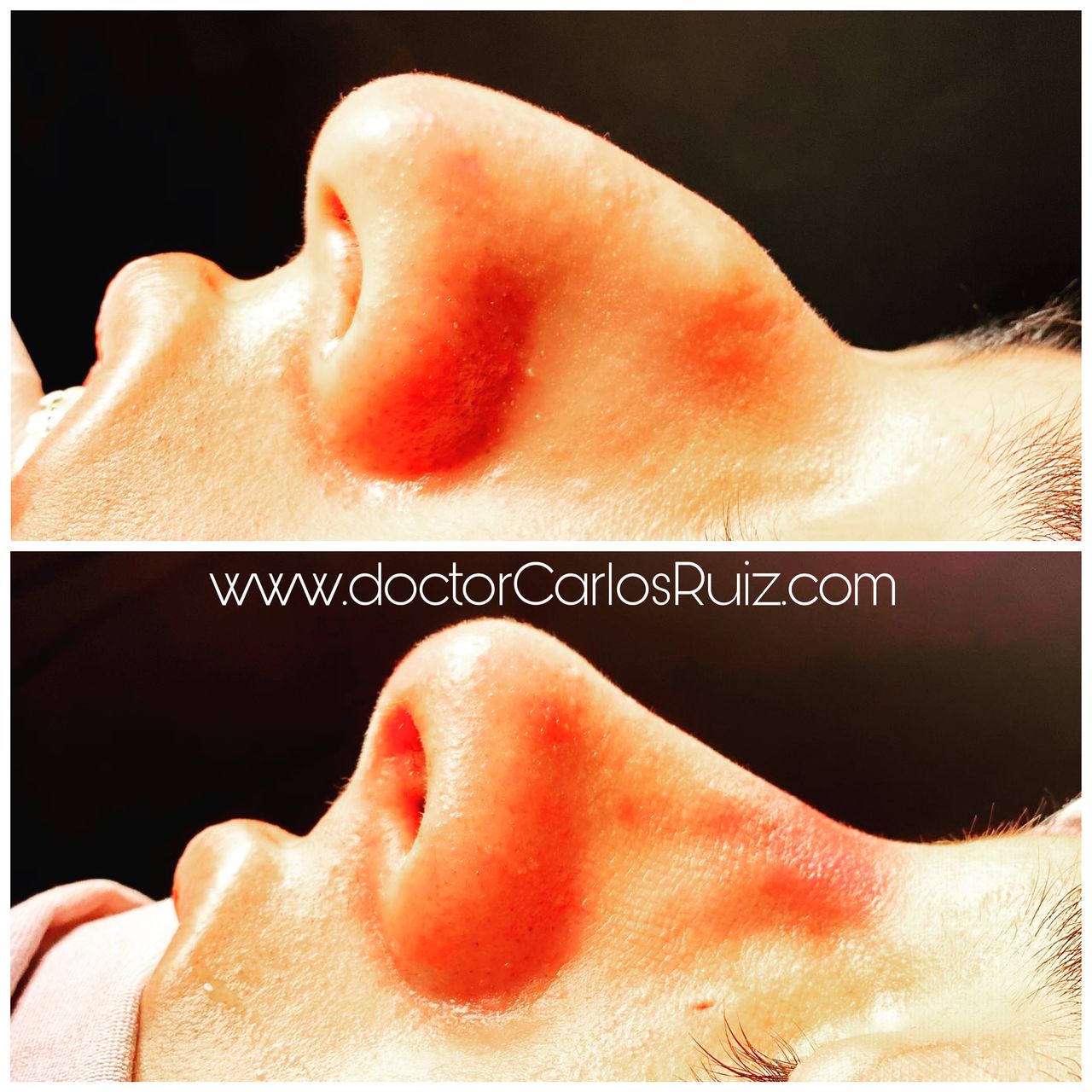 Carlos Alberto Ruiz Zepeda-28