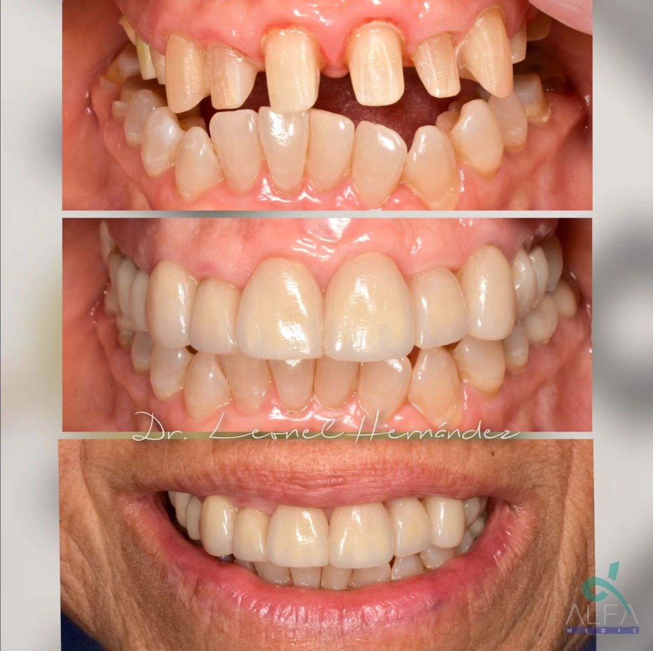 Leonel Hernández Gómez-5