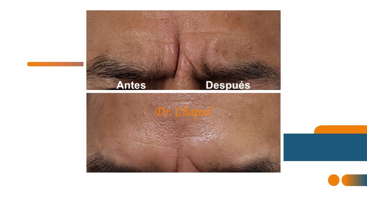 José Luis Muñoz Chapul-25