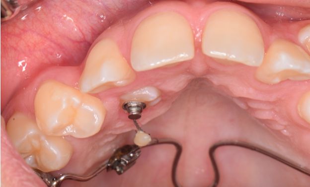 Sergio Cortes Aroche-9