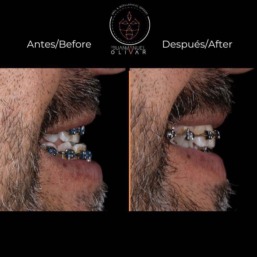 Juan Manuel Olivar Cedeño-11