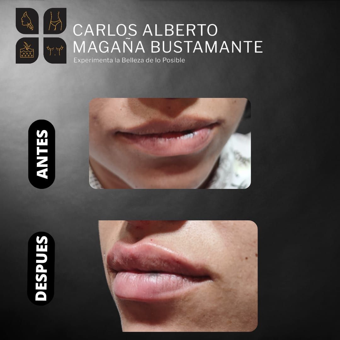 Carlos Alberto Magaña Bustamante-12