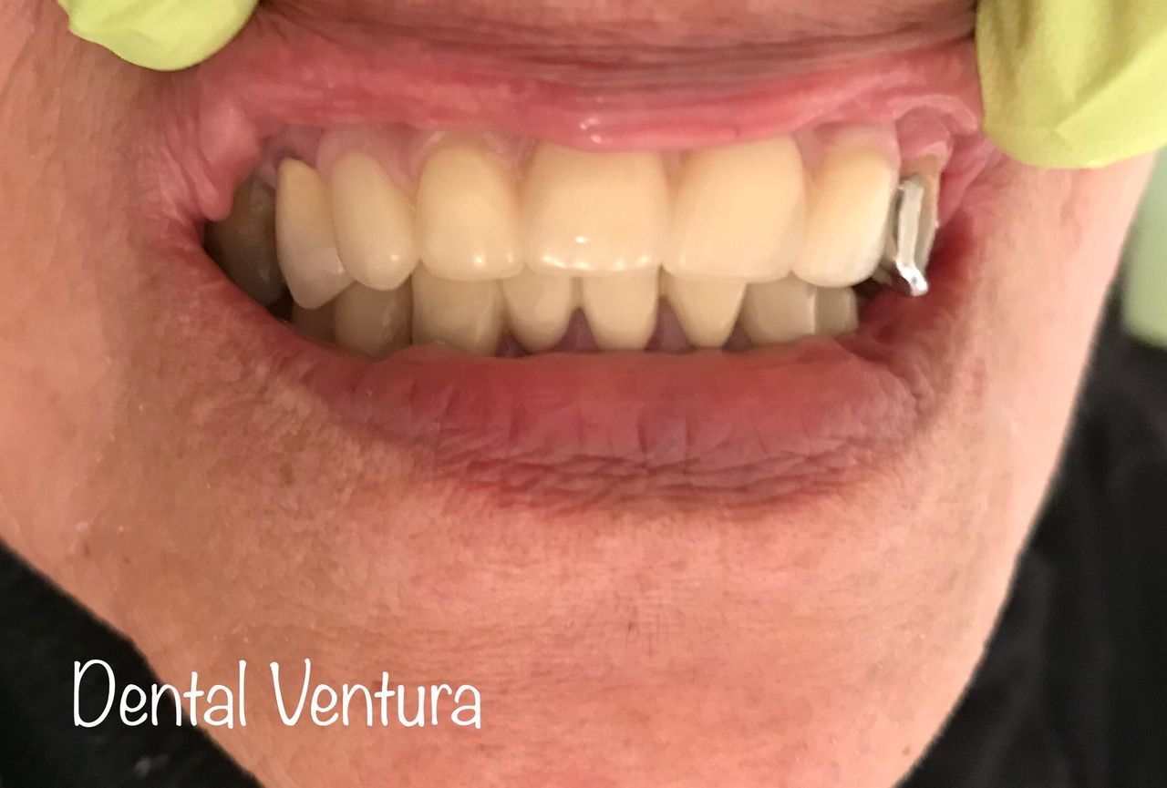 Antonio Cerda Ventura-14