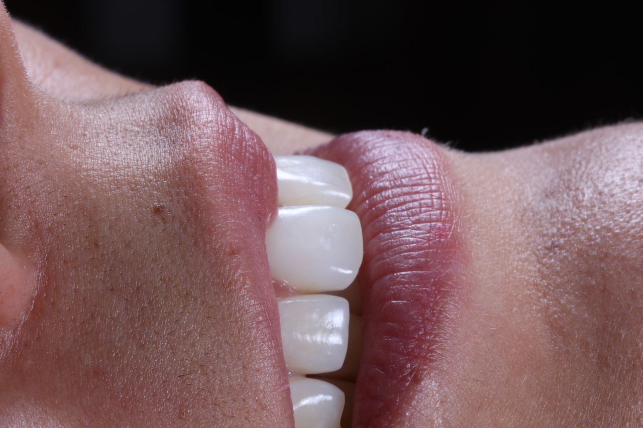 Ernesto Rojas Calderon-30