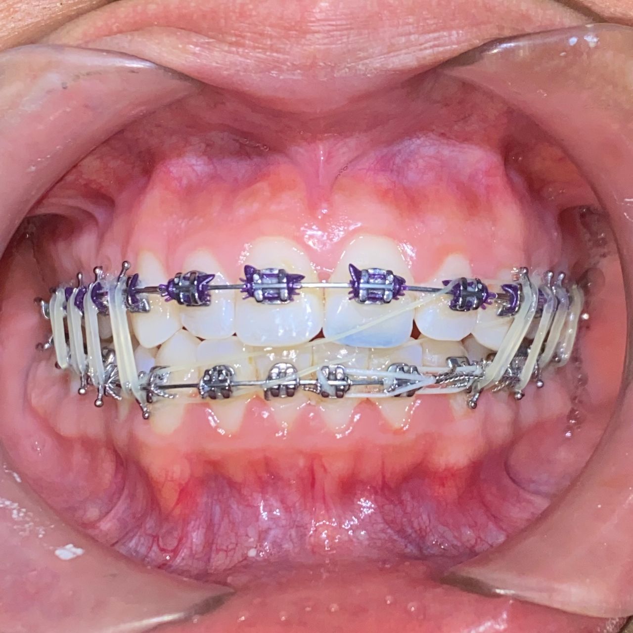 Raúl Méndez Cifuentes-1