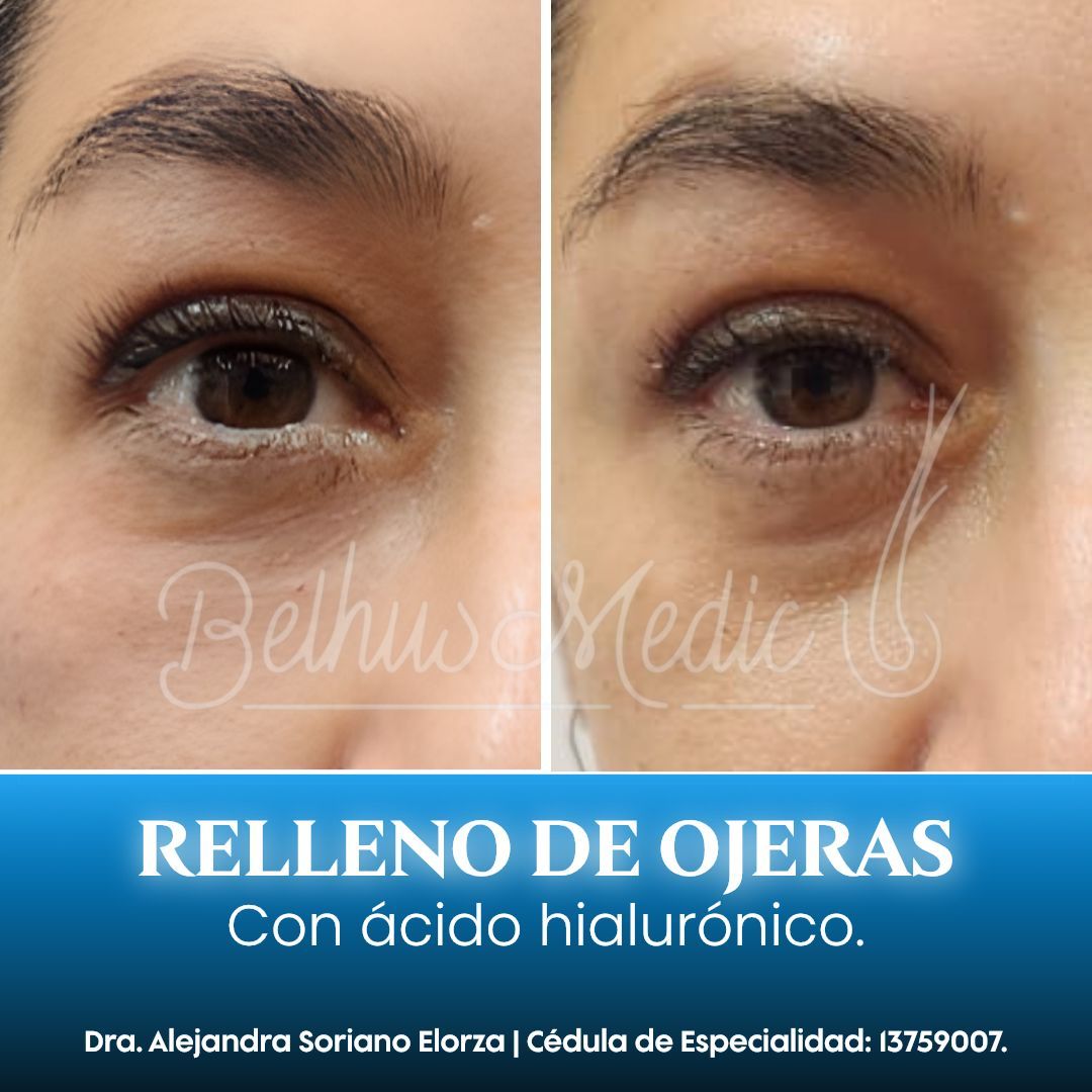 Alejandra Soriano Elorza-75