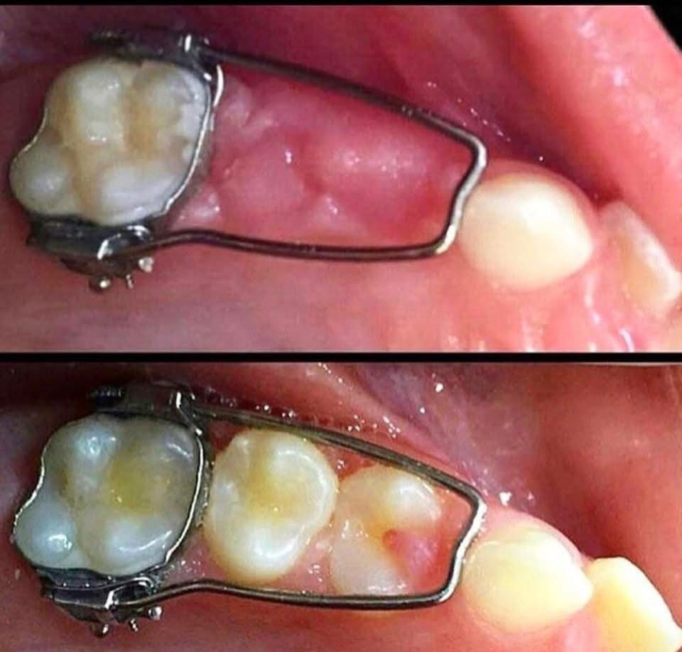 Esmeralda Candida Guerrero Pimentel-25