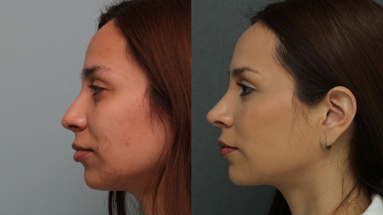 Angel Castro Urquizo-73