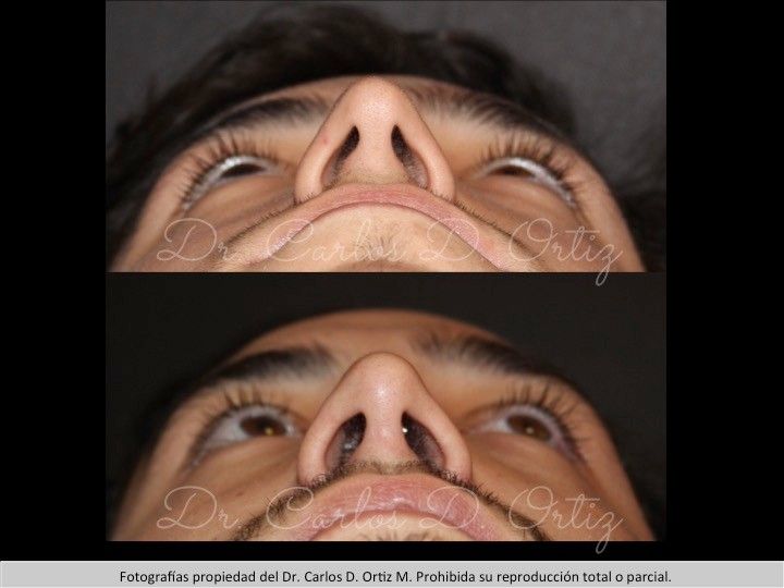 Carlos David Ortiz Moreno-17