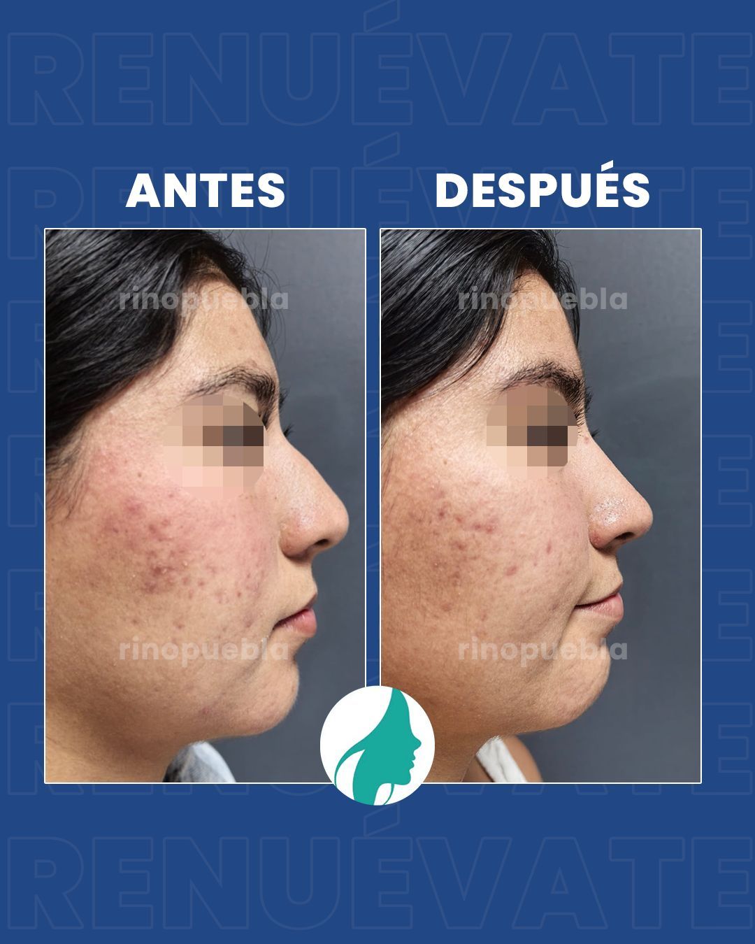 Christian Santander Becerra-24