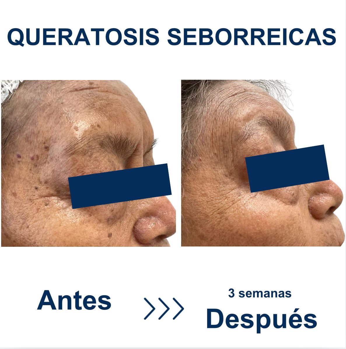 Itzel Anayn Flores Reyes-38