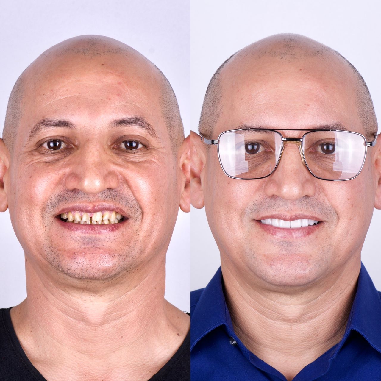 Mauricio Villegas Akena-7