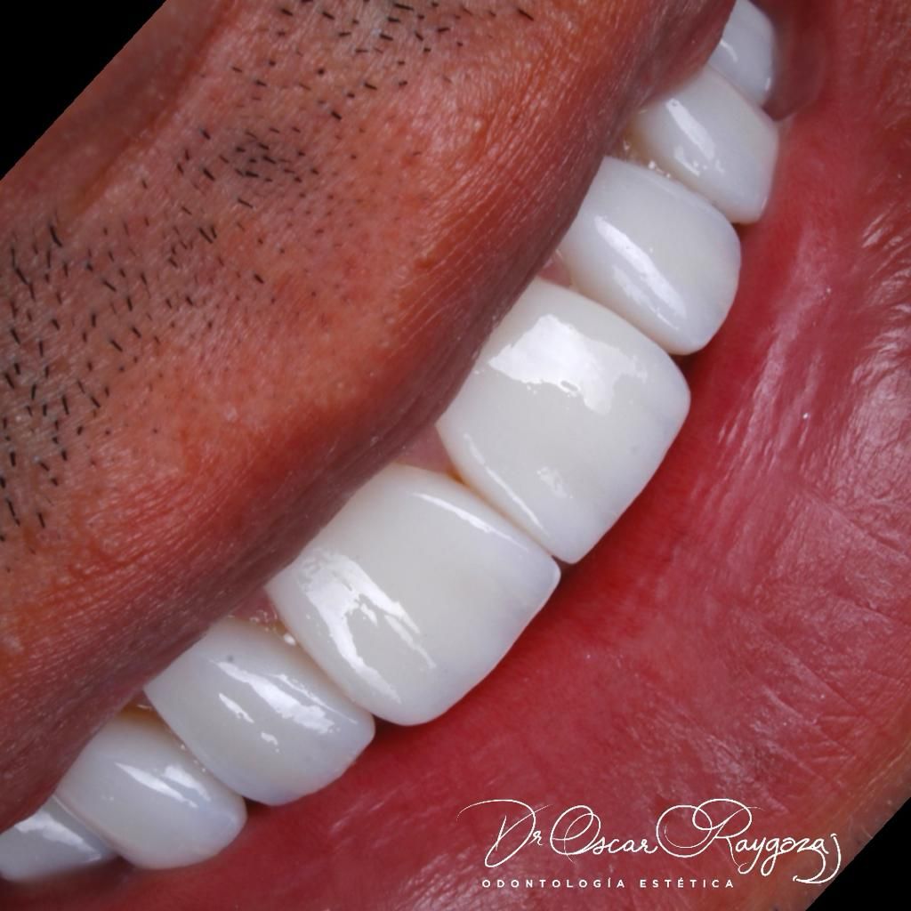 Oscar Raygoza Carrillo-5