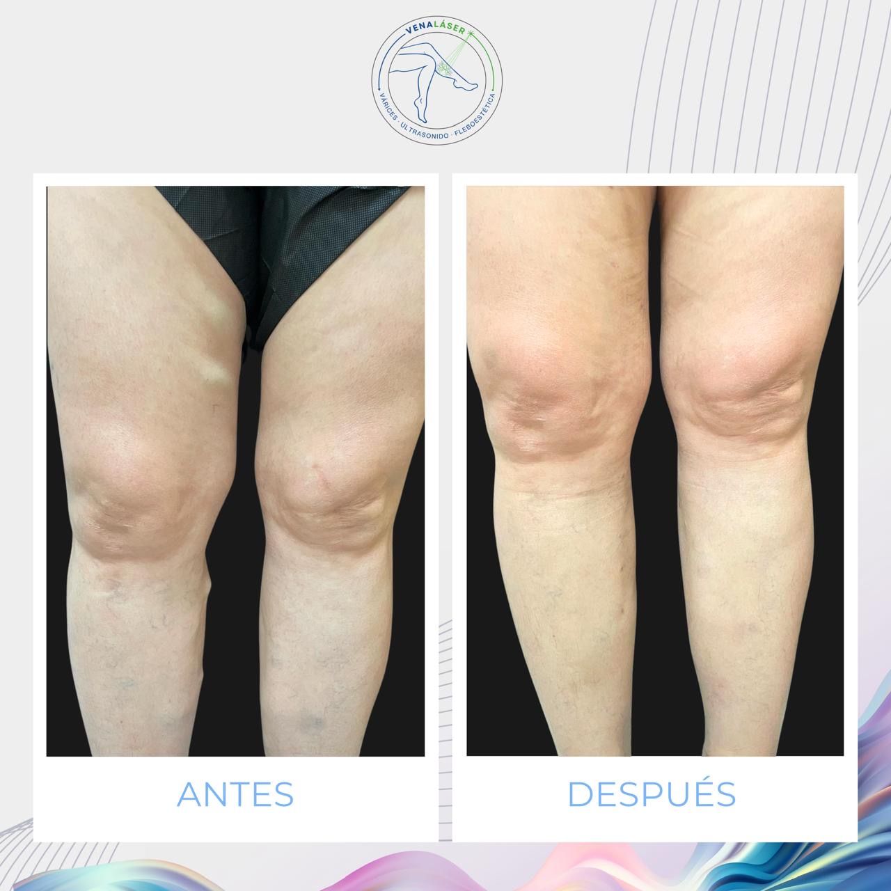 Mishell Eduardo Santander Becerra-11