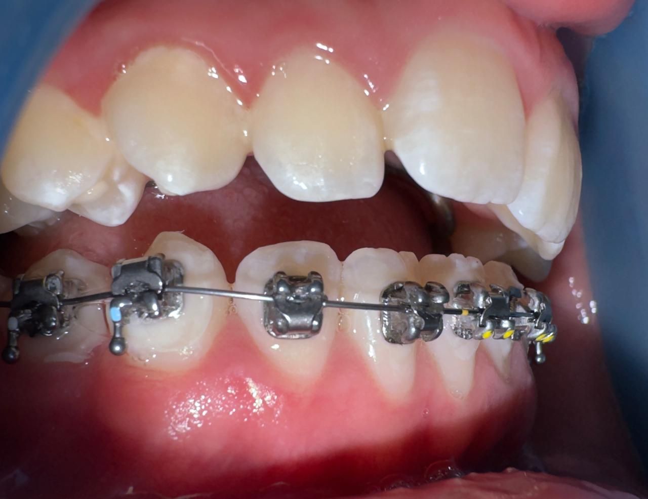 Miguel Angel Garita Cruz-9