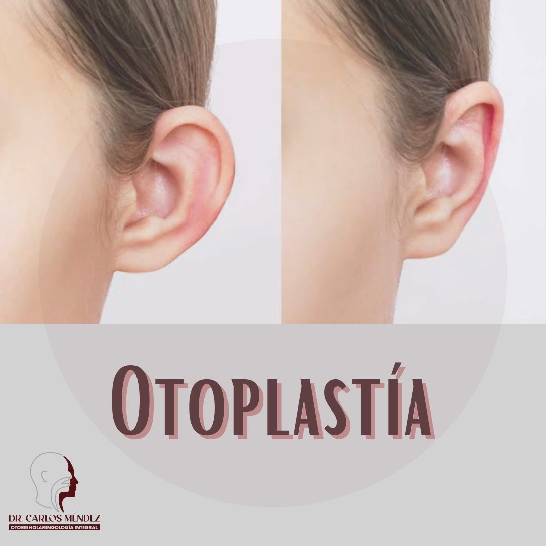 Juan Carlos Mendez Gutierrez-42