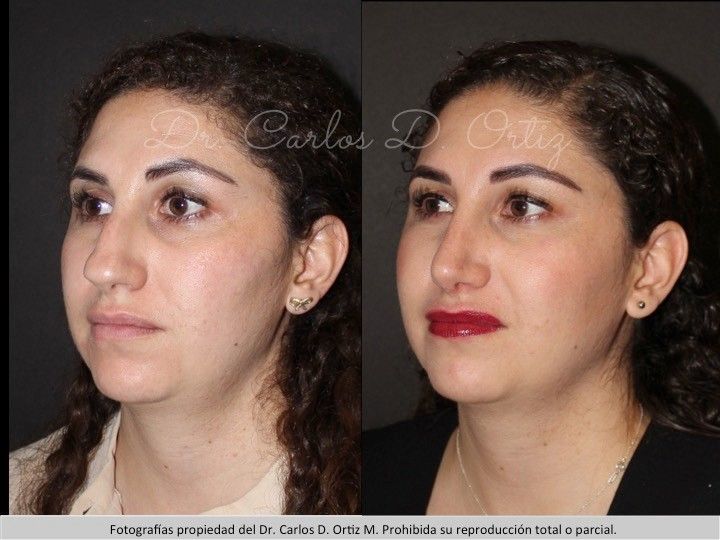 Carlos David Ortiz Moreno-23