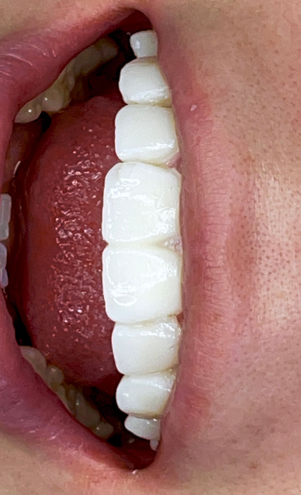 Oscar Alejandro Azcárate Tendilla-4