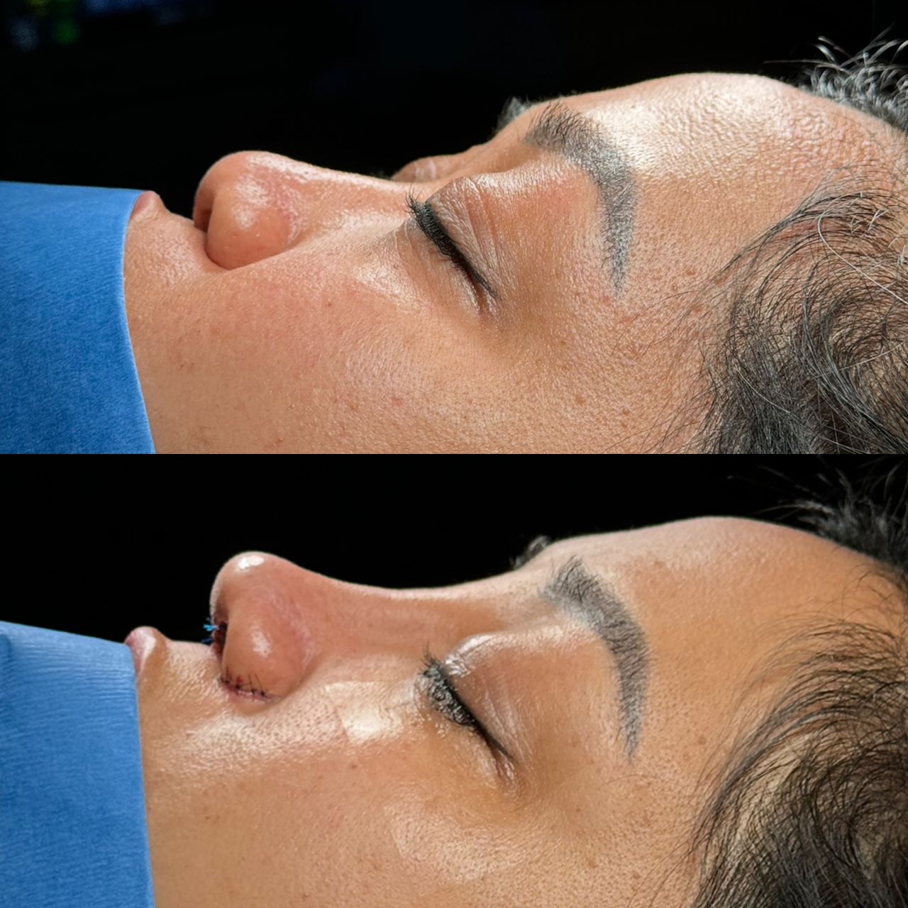 Angel Castro Urquizo-19