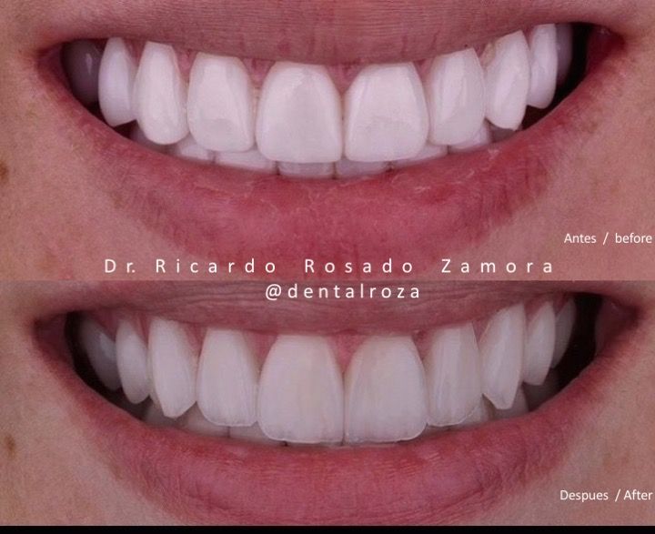 Ricardo Rosado Zamora-39