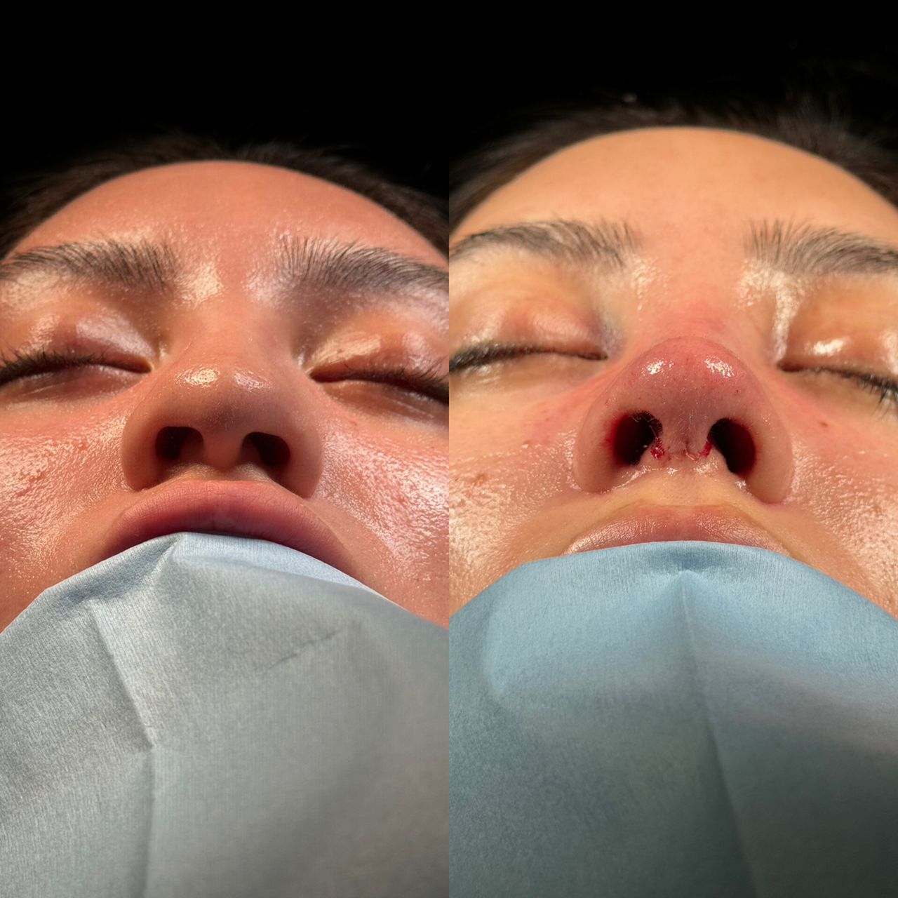 Angel Castro Urquizo-106