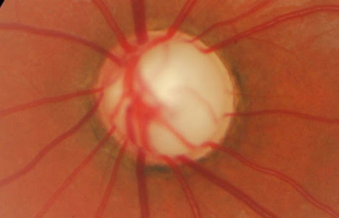 Javier Suárez Arguello-11