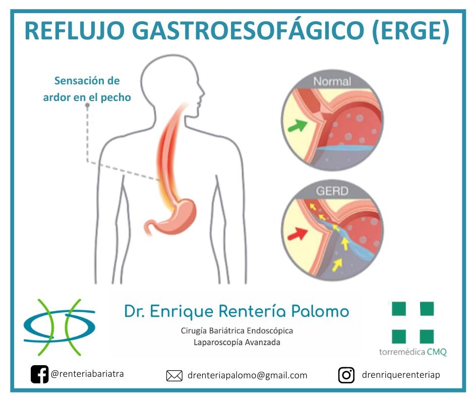 Enrique Rentería Palomo-44