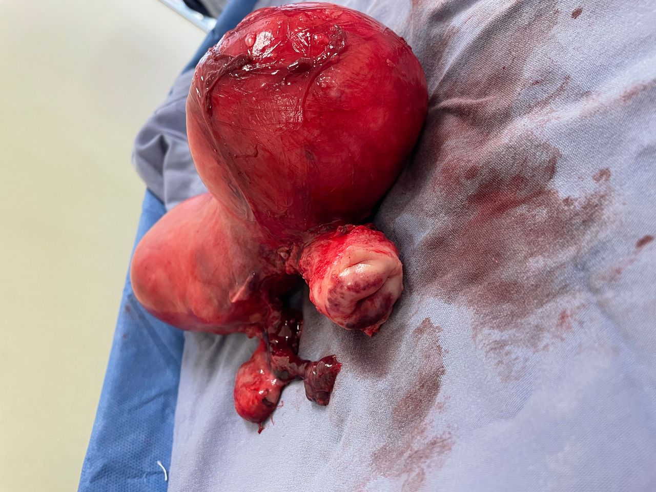 Gonzalo Hernández Martínez-42