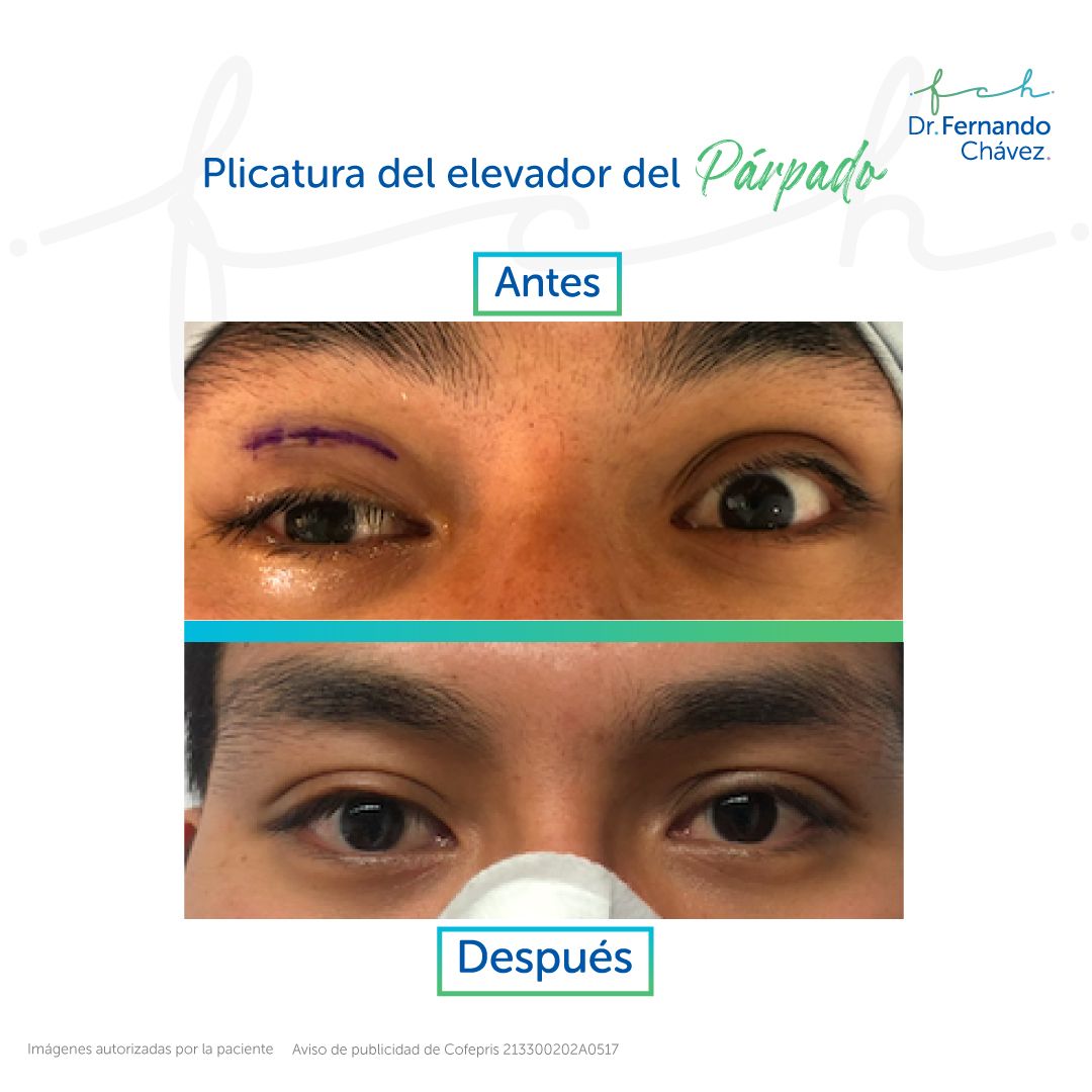 Fernando Chávez Osorio-19