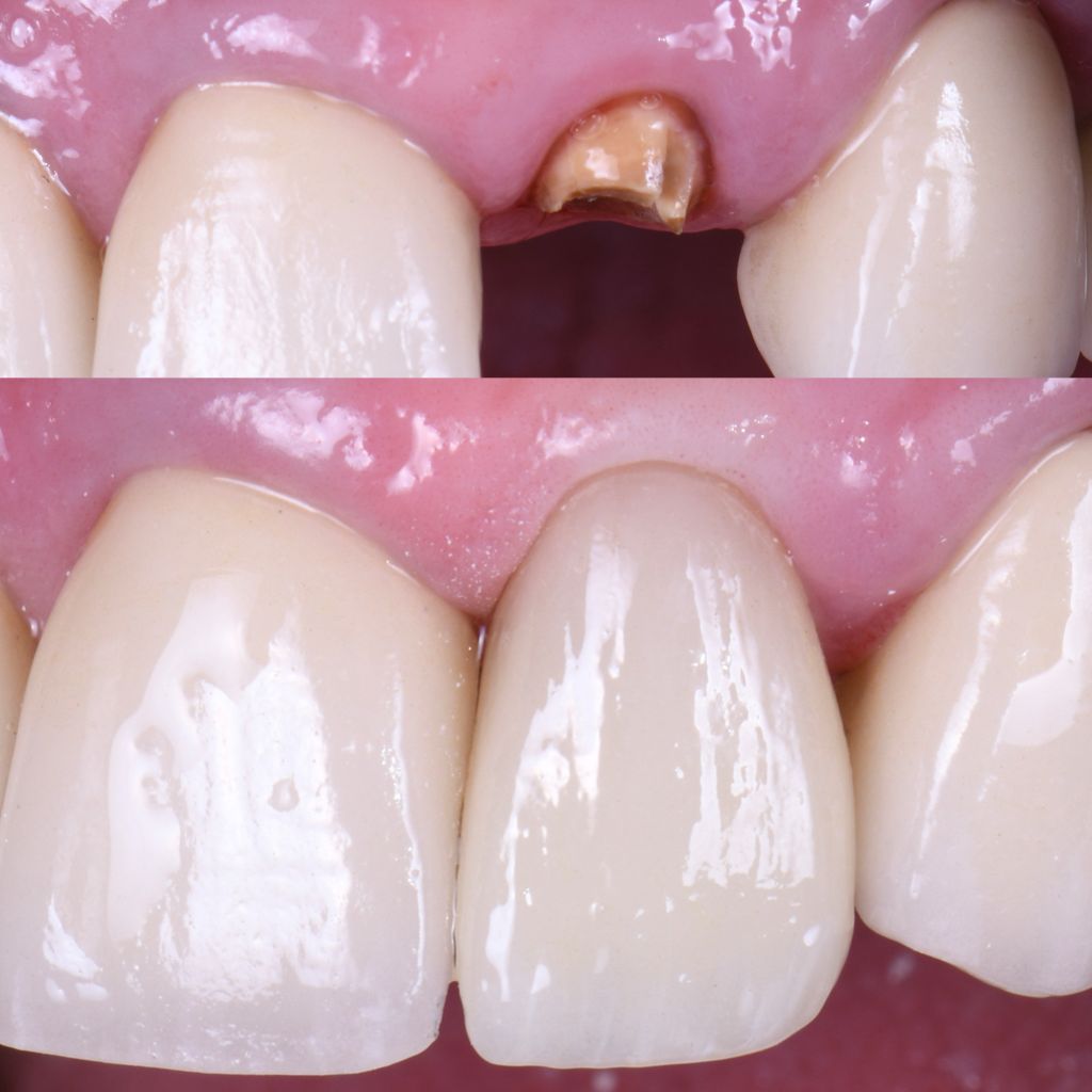 Ricardo López Lemus-106