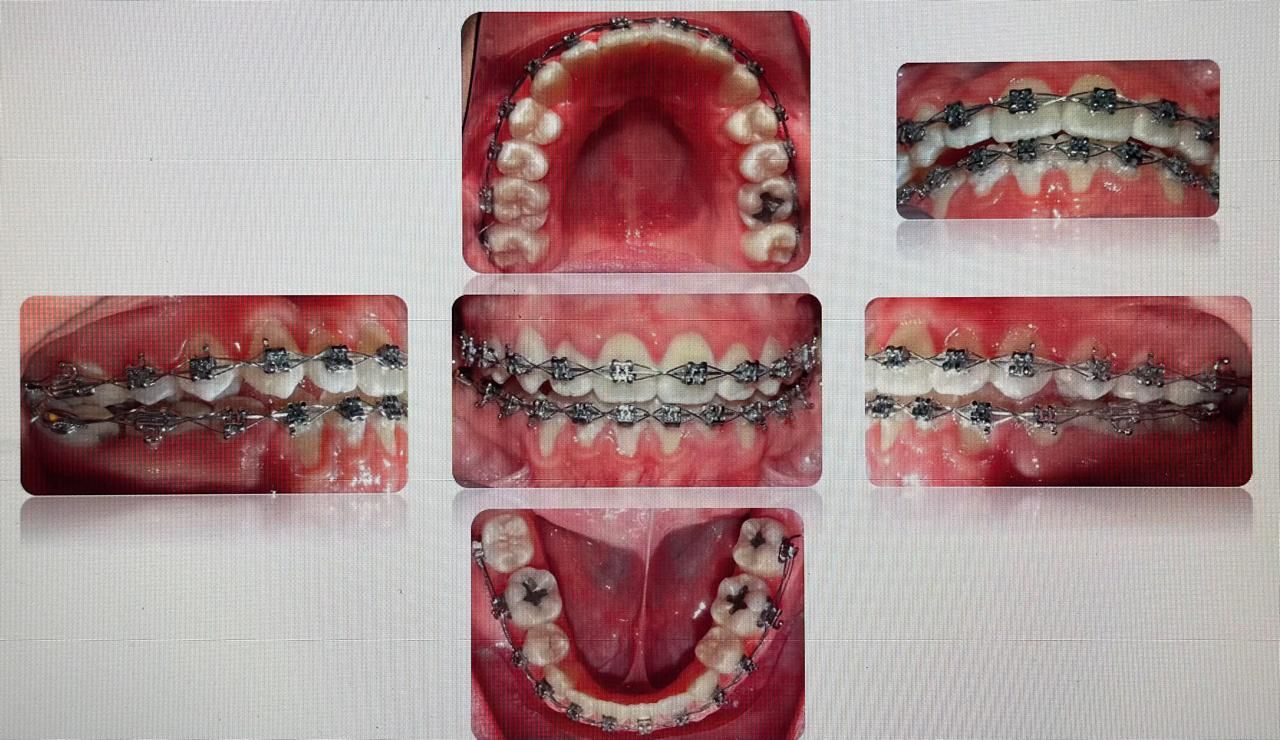 Antonio Gomez Arenas-11