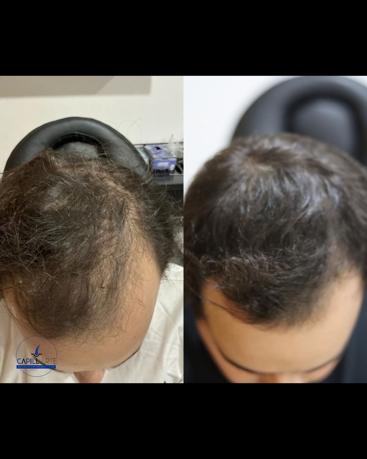 Adrian Hernandez Lopez-9