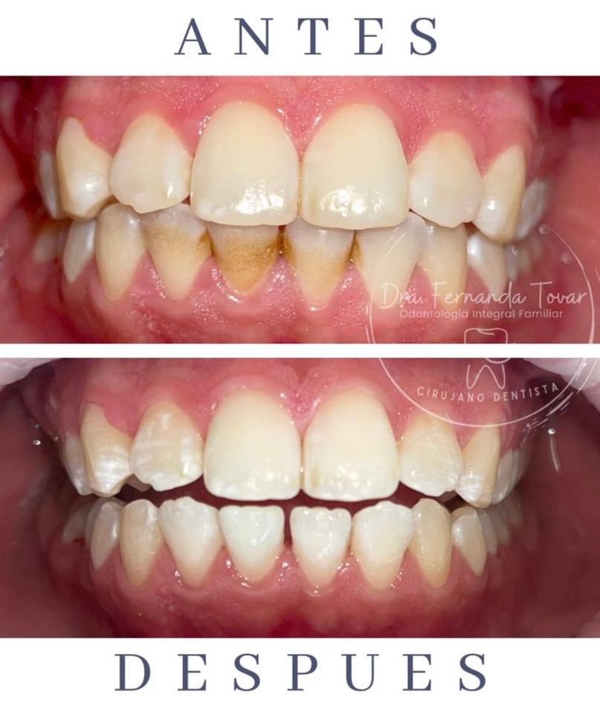 Fernanda Tovar Navarro-8