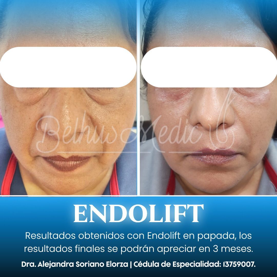 Alejandra Soriano Elorza-73