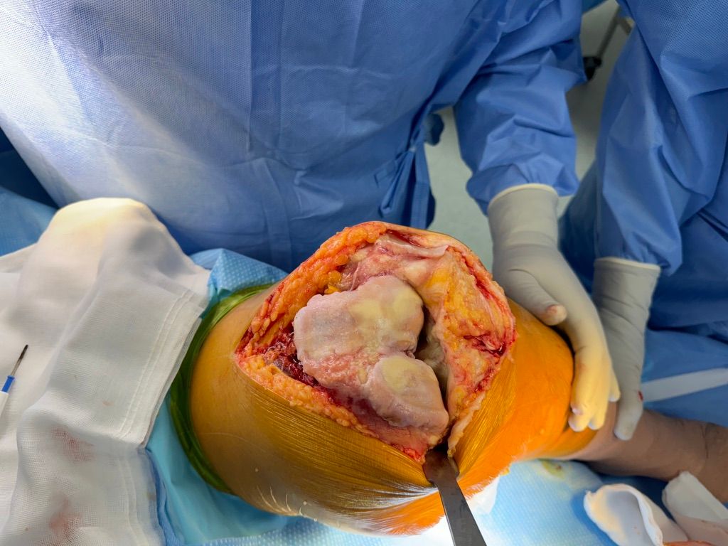 Gisela Cleto Zepeda-101