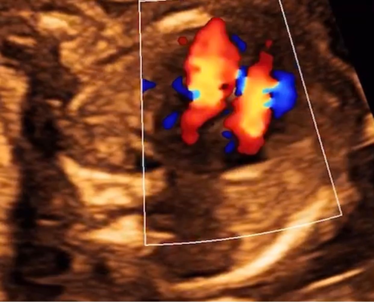 Ricardo Morales Velázquez-1