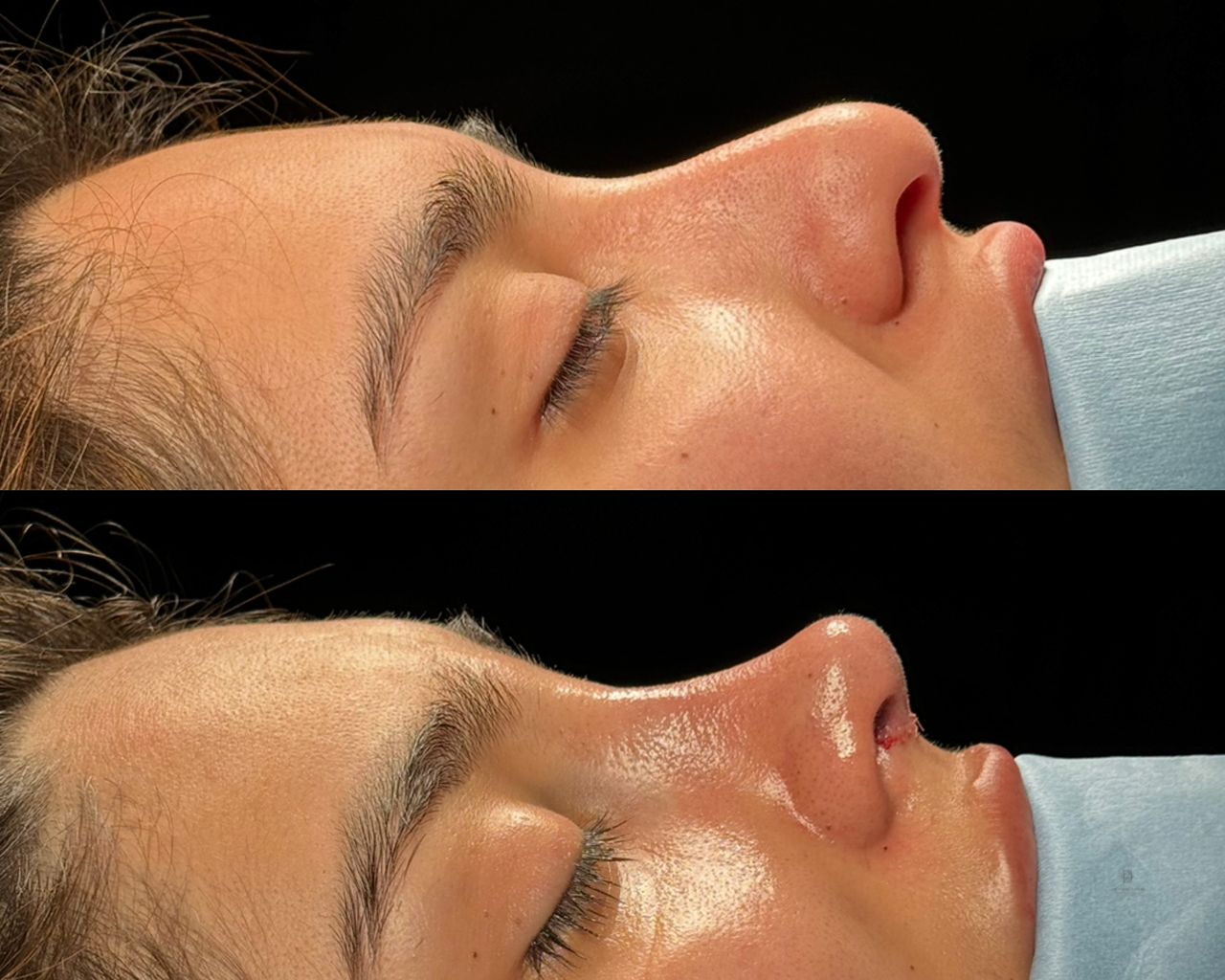 Angel Castro Urquizo-66