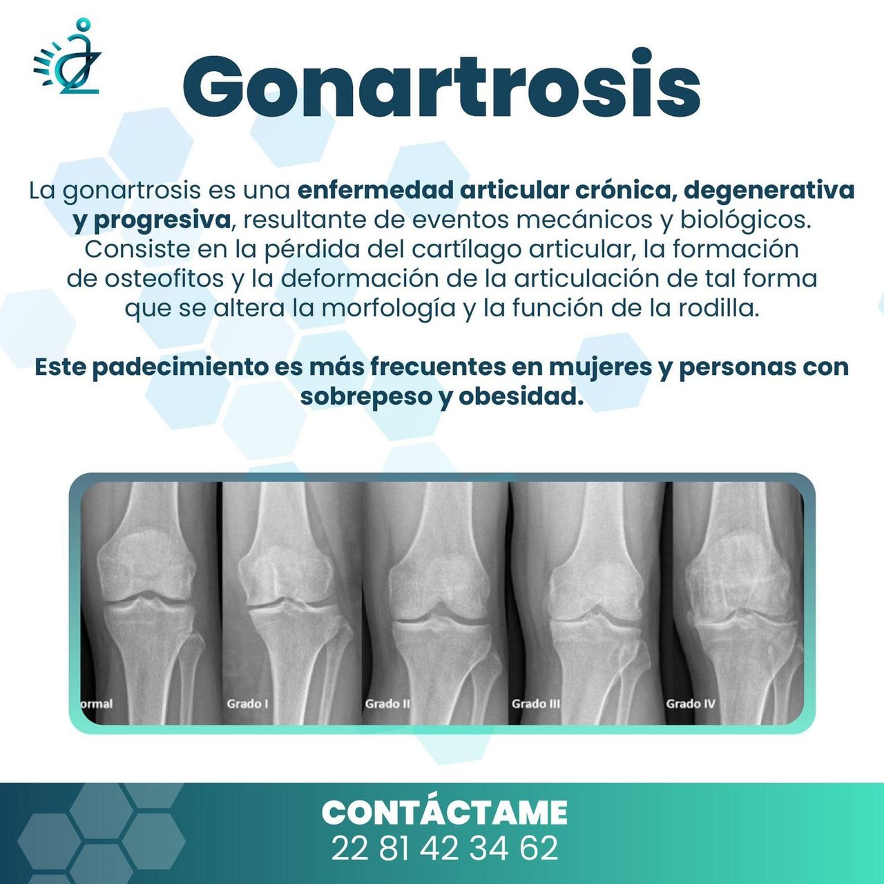 Aulio Cesar Ibarra Zavala-1