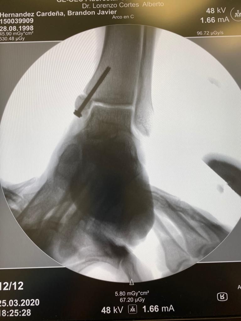 Alberto Lorenzo Cortés-21