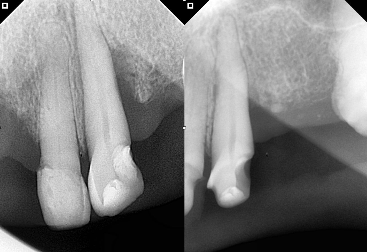 Luis Alonso Flores Reyna-0