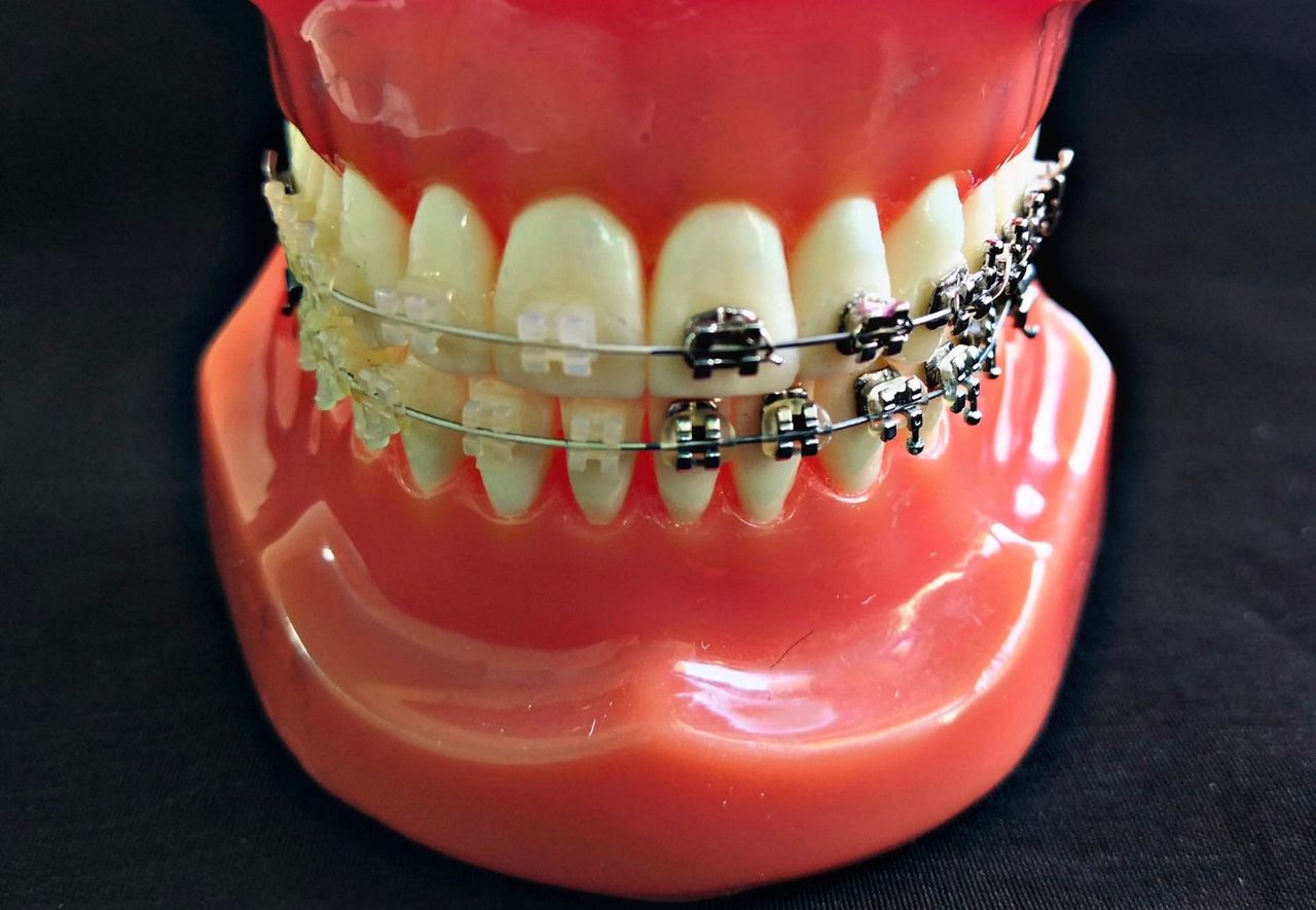 Alejandro Angelo López Díaz-6