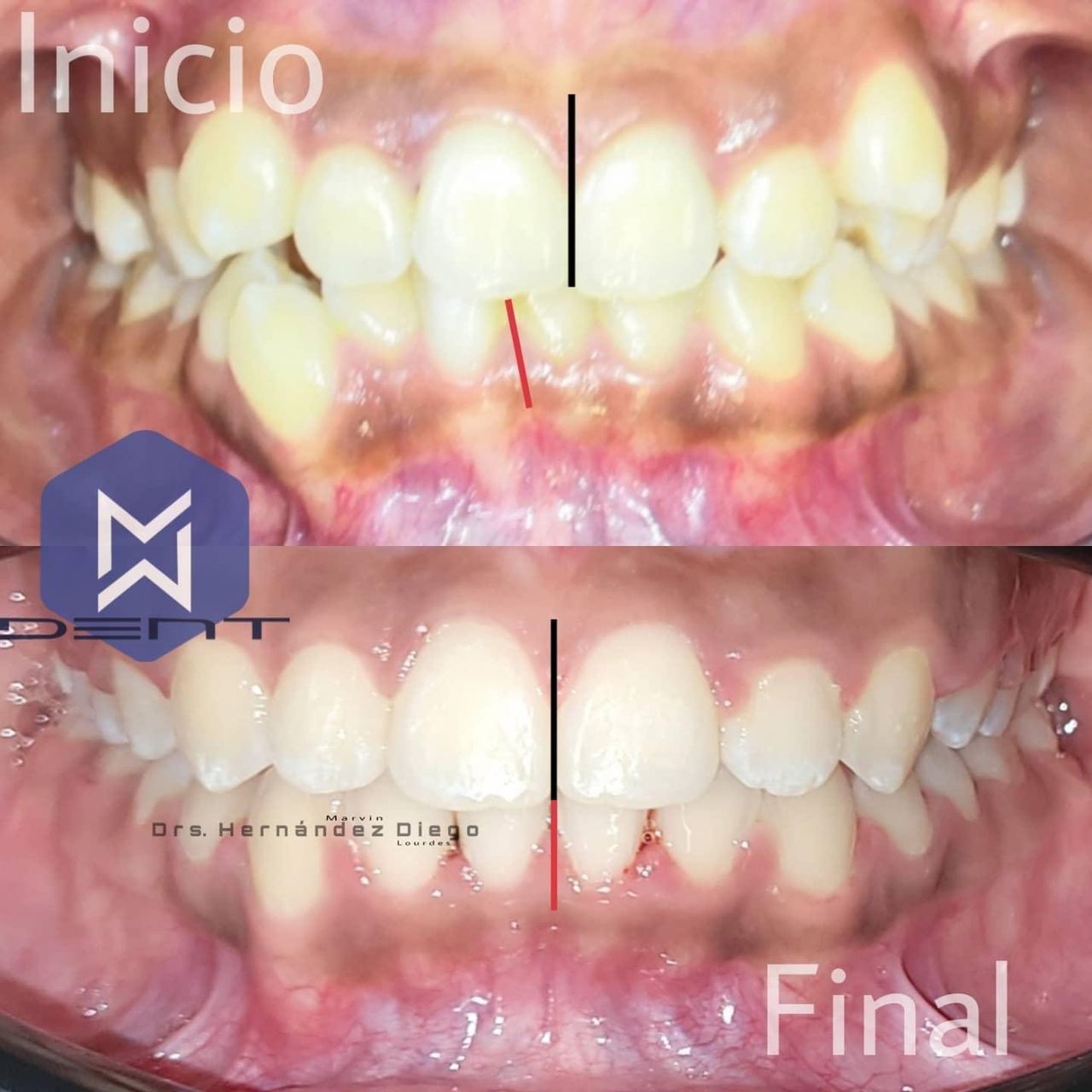 Marvin Adair Hernández Álvarez-32