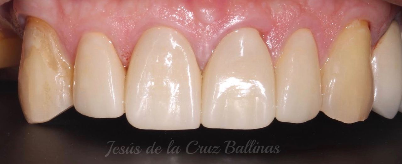 Jesus De La Cruz Ballinas-43